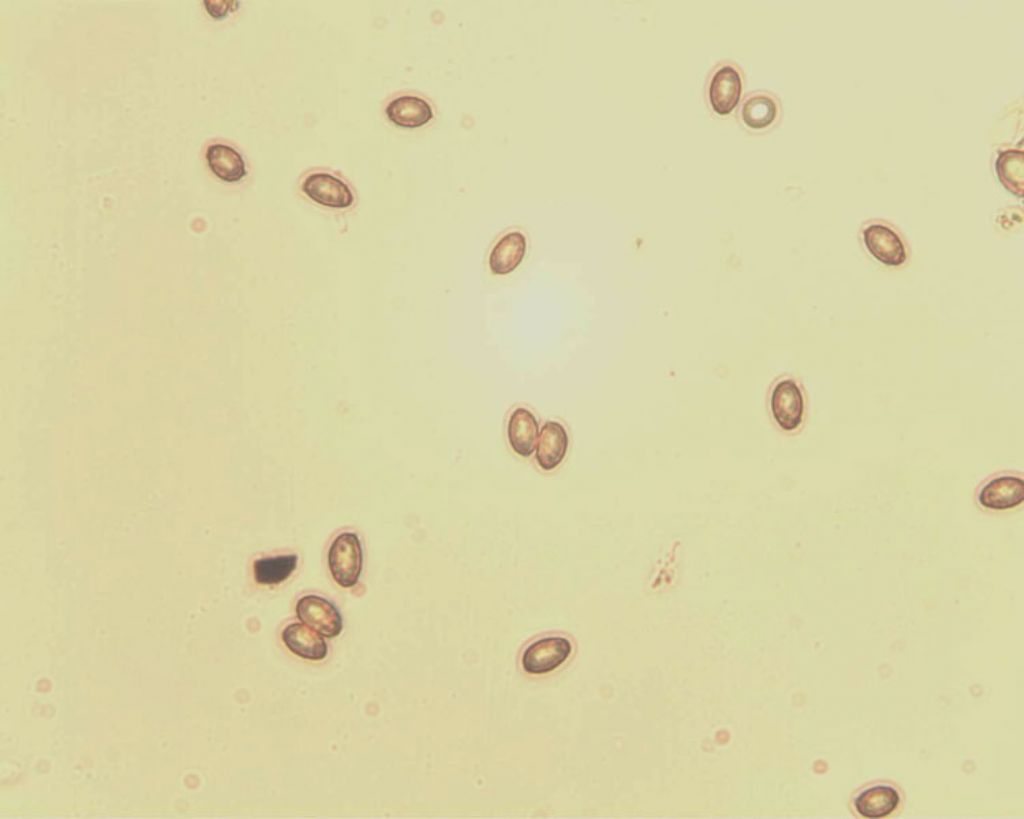 misurazioni al microscopio